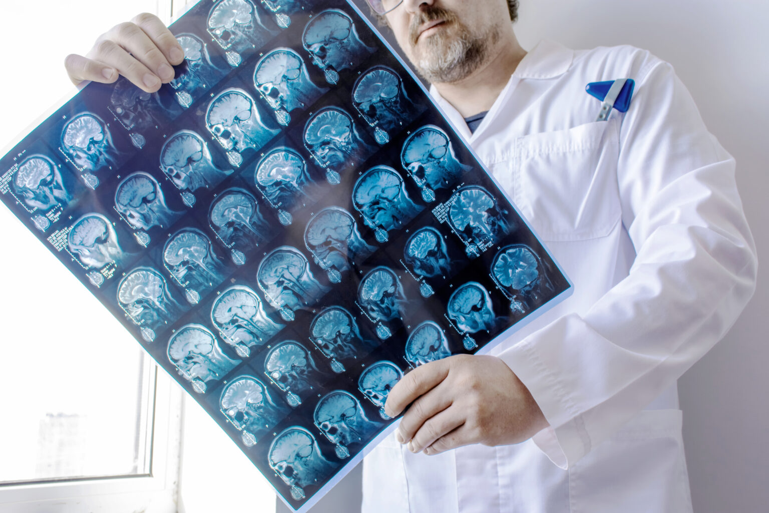 Väčšiemu zameraniu na neurodegeneratívne ochorenia bráni i dátová hmla