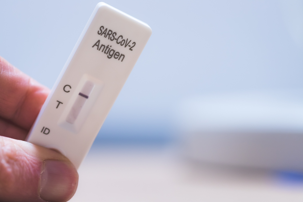 Kontrola covidových mobilných odberových miest dopadla katastrofálne. Kľúčová databáza bola dokonca vymazaná