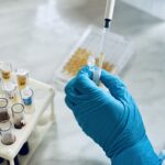 Šírenie žltačky v Nitrianskom kraji je mimoriadne vážne, poslanci hovoria o kritickej situácii