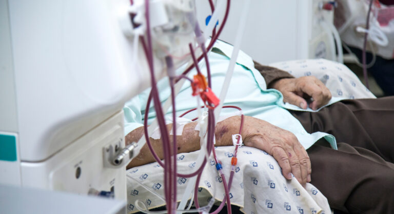 Dialýzu potrebuje čoraz viac seniorov, najčastejším dôvodom je cukrovka