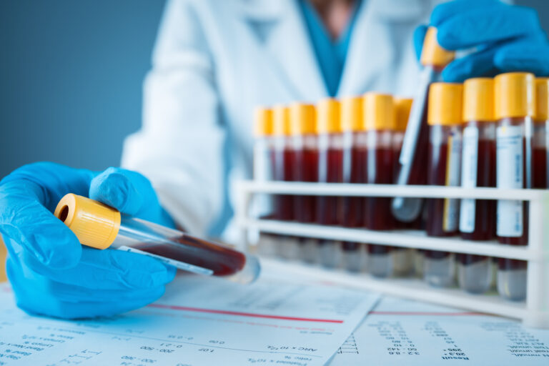 Štúdia spája Parkinsonovu chorobu so zmenami imunitných buniek v krvi