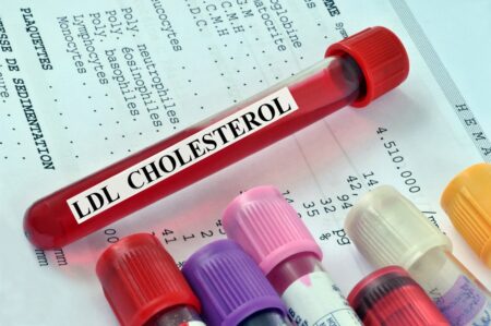 Prekvapenie vedcov: aj nízky cholesterol zvyšuje riziko úmrtia