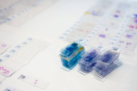Prelom v diagnostike: Koniec sklíčok a mikroskopov, vzorky putujú na monitor