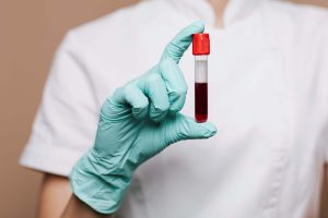 Nový krvný test môže výrazne zjednodušiť diagnostiku Alzheimerovej choroby