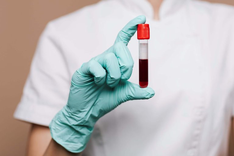 Nový krvný test môže výrazne zjednodušiť diagnostiku Alzheimerovej choroby